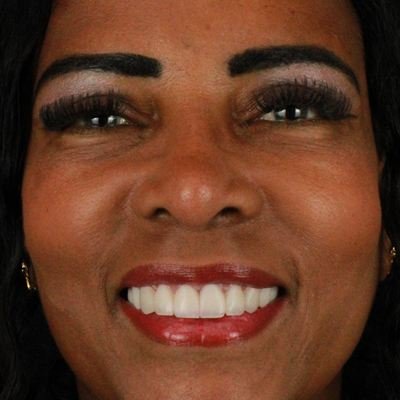 Paciente sorrindo após o tratamento