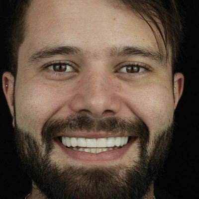 Paciente sorrindo após o tratamento