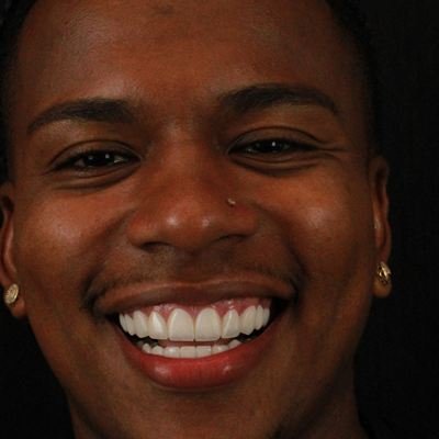Paciente sorrindo após o tratamento